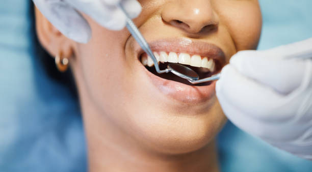 Best Emergency Dental Care for Sports Injuries in East Alton, IL