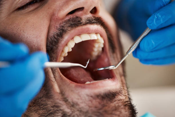 Best Emergency Treatment for Jaw Pain or Injury in East Alton, IL