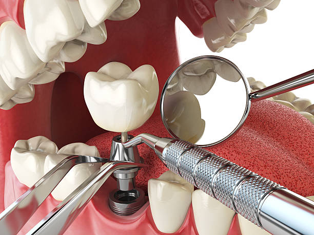 Best Weekend Emergency Dental Services in East Alton, IL